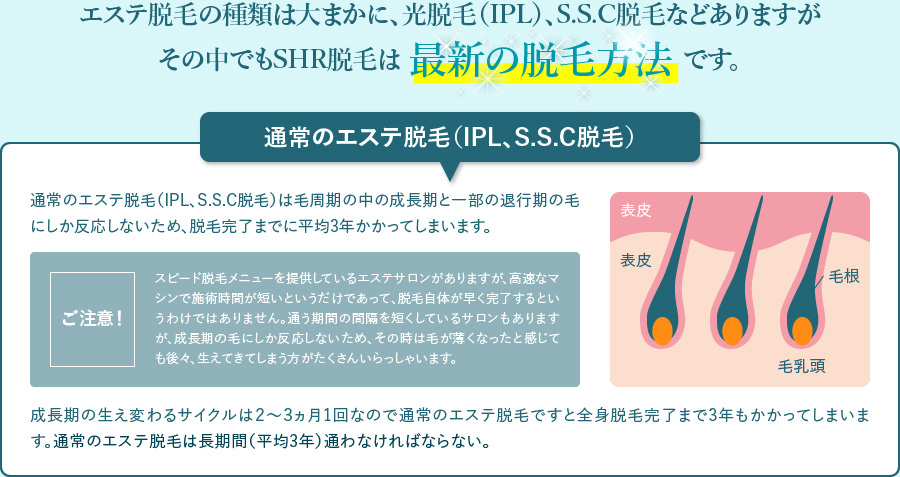 エステ脱毛の種類は大まかに、光脱毛（IPL）、S.S.C脱毛などありますがその中でもSHR脱毛は 最新の脱毛方法 です。
            通常のエステ脱毛（IPL、S.S.C脱毛）

            通常のエステ脱毛（IPL、S.S.C脱毛）は毛周期の中の成長期と一部の退行期の毛にしか反応しないため、脱毛完了までに平均3年かかってしまいます。
            ［ご注意！］スピード脱毛メニューを提供しているエステサロンがありますが、高速なマシンで施術時間が短いというだけであって、脱毛自体が早く完了するというわけではありません。通う期間の間隔を短くしているサロンもありますが、成長期の毛にしか反応しないため、その時は毛が薄くなったと感じても後々、生えてきてしまう方がたくさんいらっしゃいます。

            成長期の生え変わるサイクルは２～３ヵ月1回なので通常のエステ脱毛ですと全身脱毛完了まで3年もかかってしまいます。通常のエステ脱毛は長期間（平均3年）通わなければならない。
            